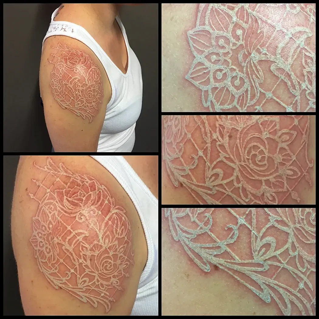 Белые тату после заживления