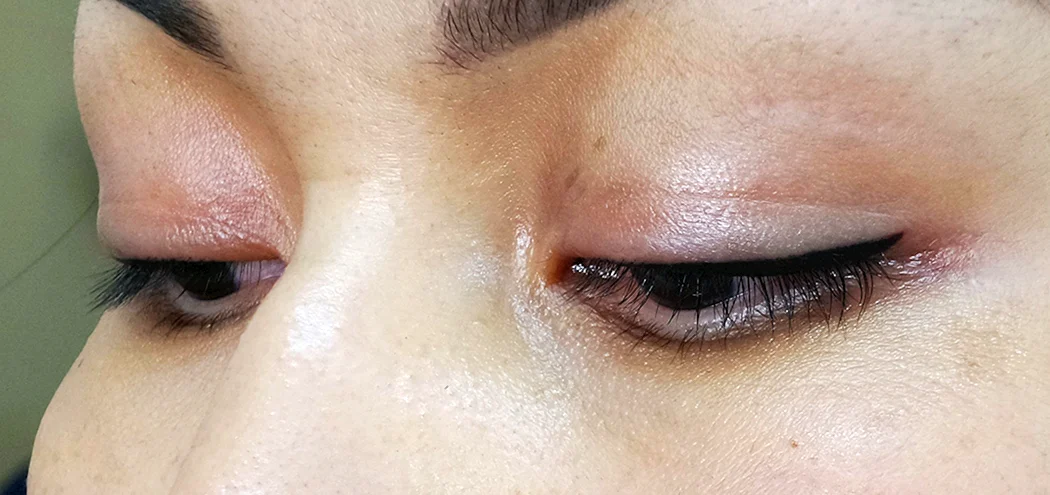 Наколка на веке полоска