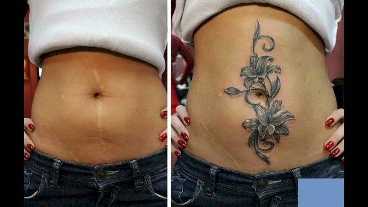 Тату перекрытие кесарева шрама