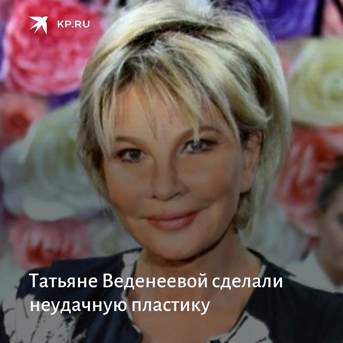 Татьяна Веденеева до и после пластики