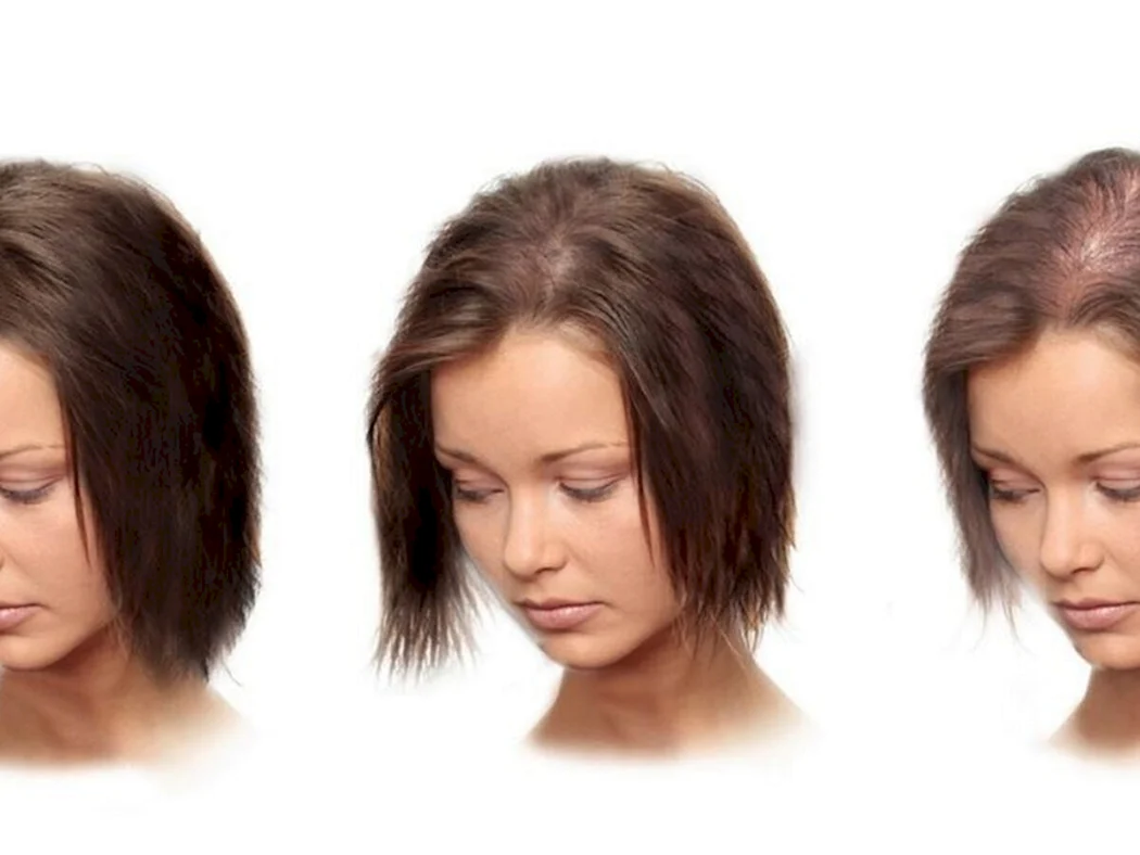 Редкие волосы