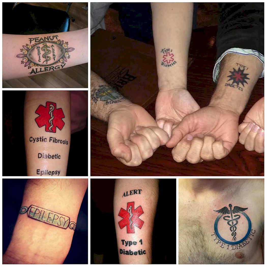 Татуировки скорой помощи