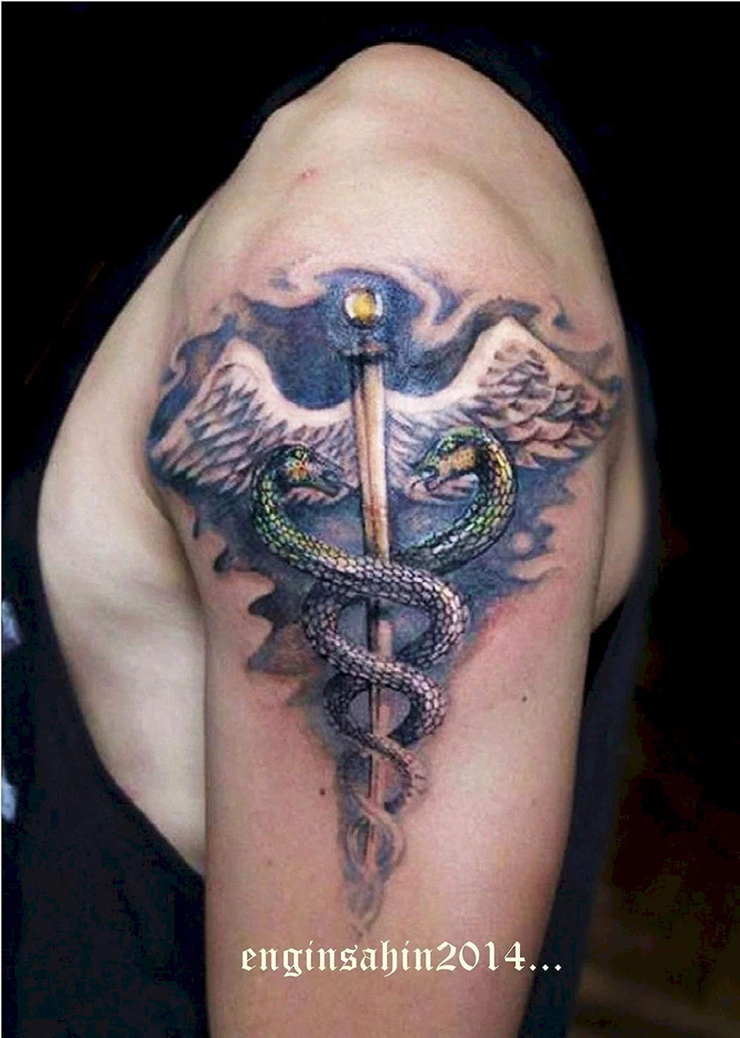 Медицинские тату