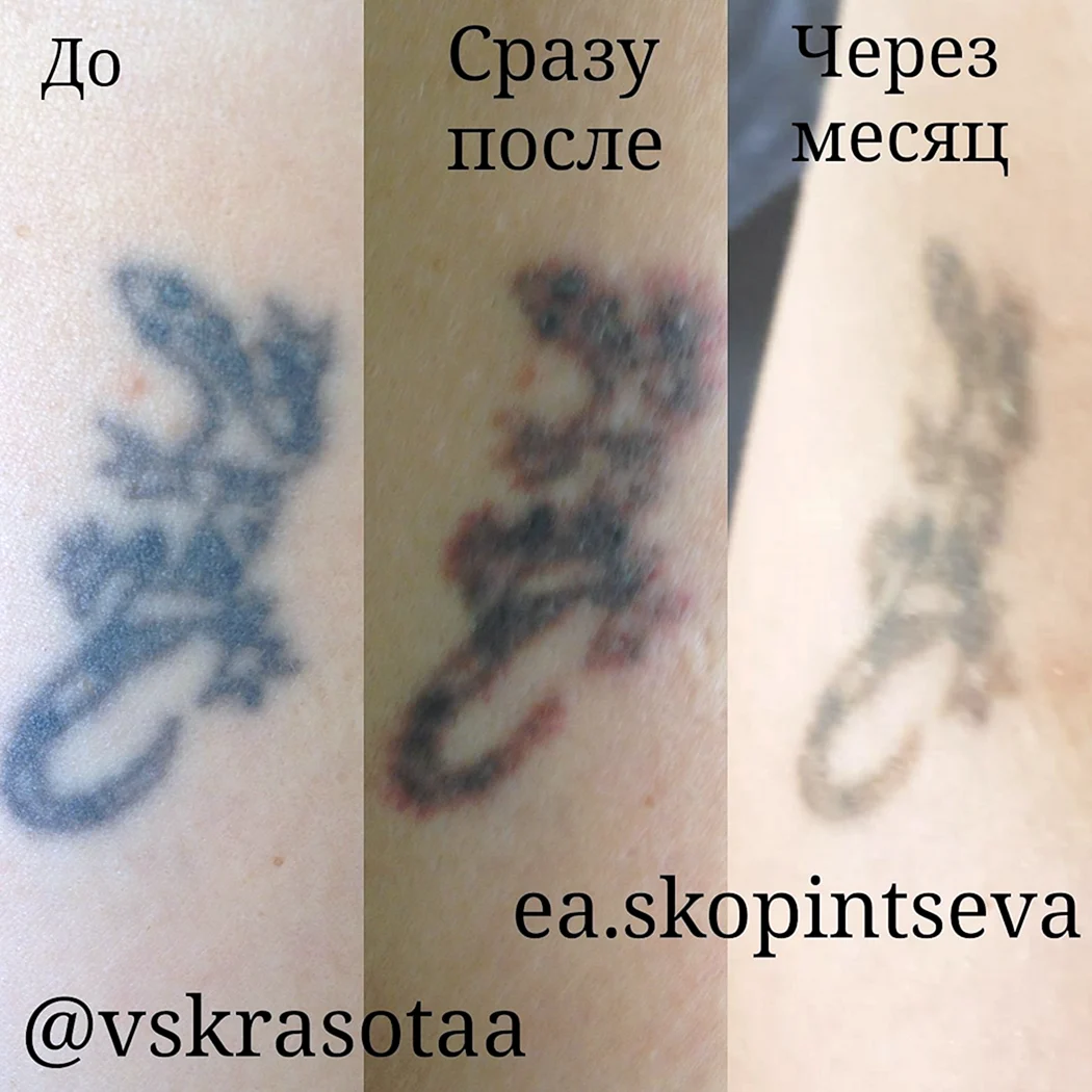 Тату до и после заживления