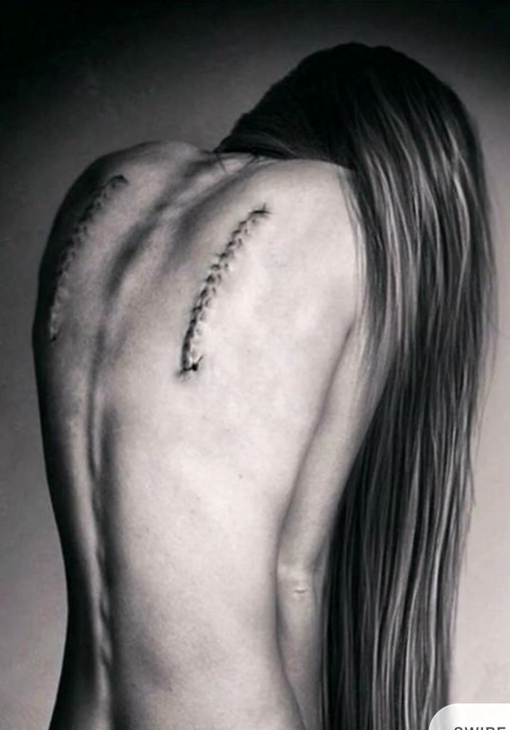 Обрезанные Крылья на спине