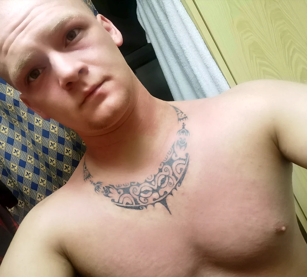 Аллергический дерматит тату