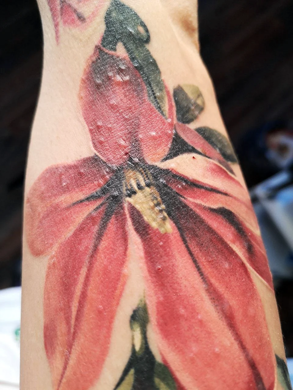 Аллергическая реакция на тату