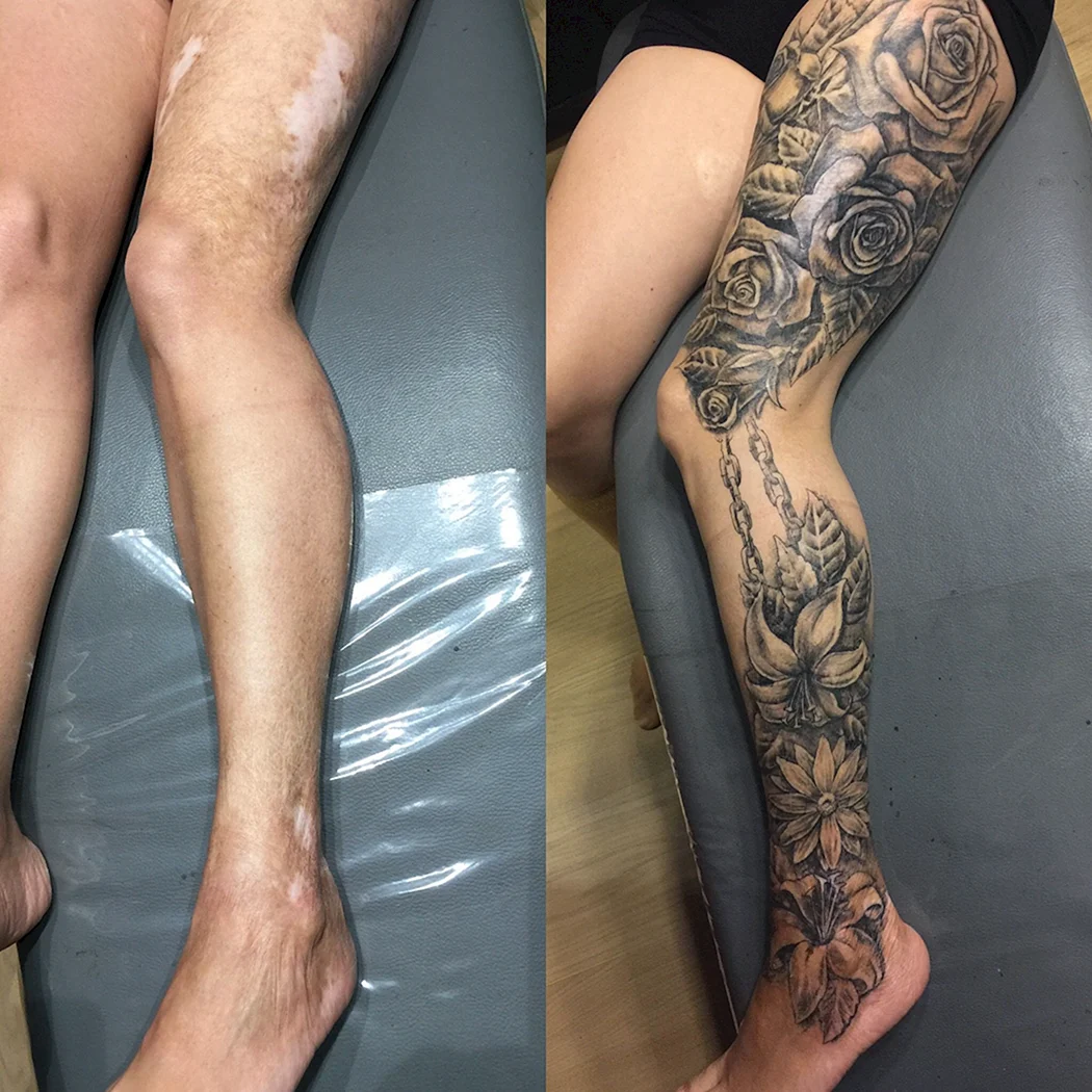 Тату перекрытие шрамов на ноге