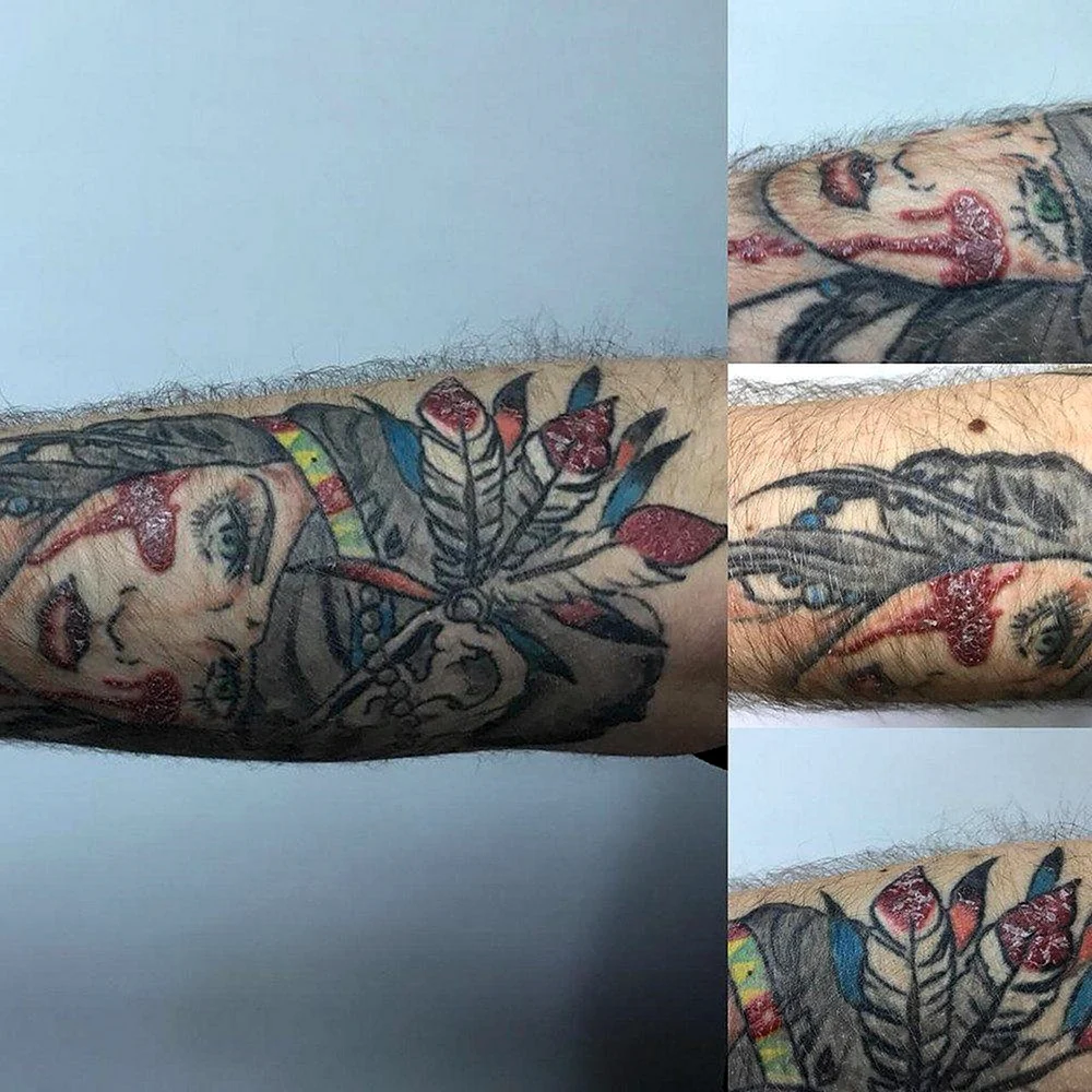 Период заживления тату