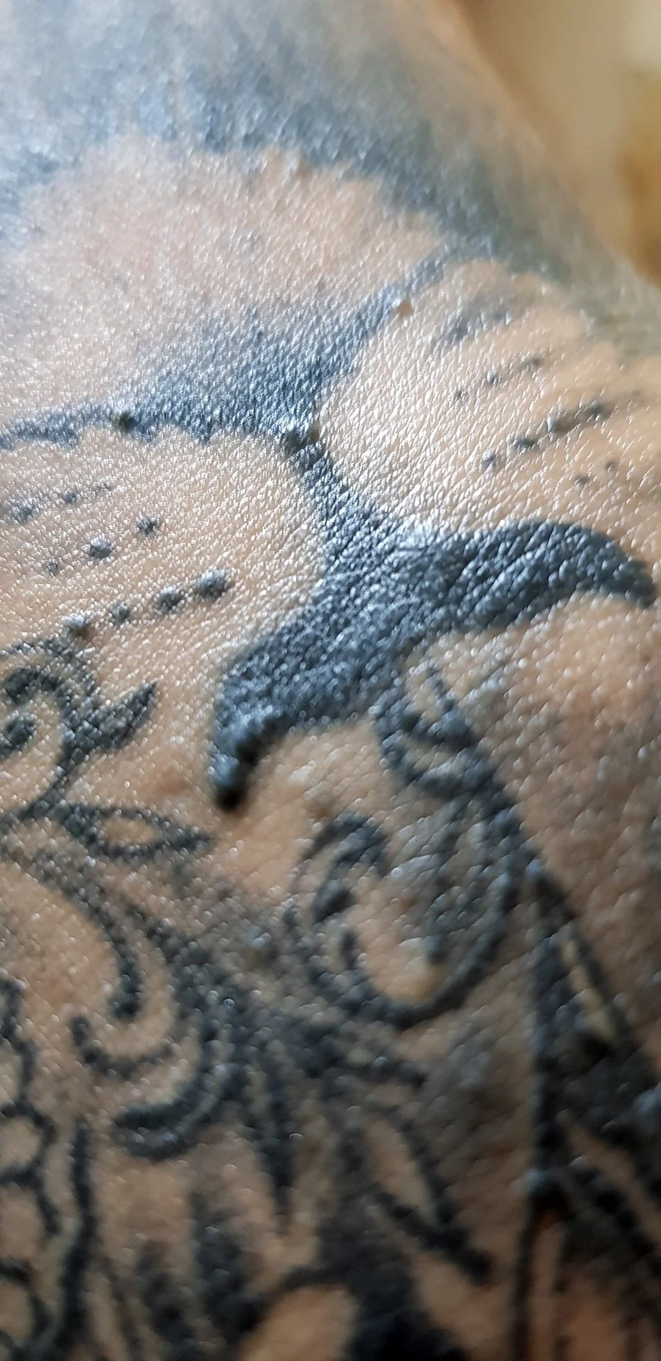 Маленькие прыщики на татуировке