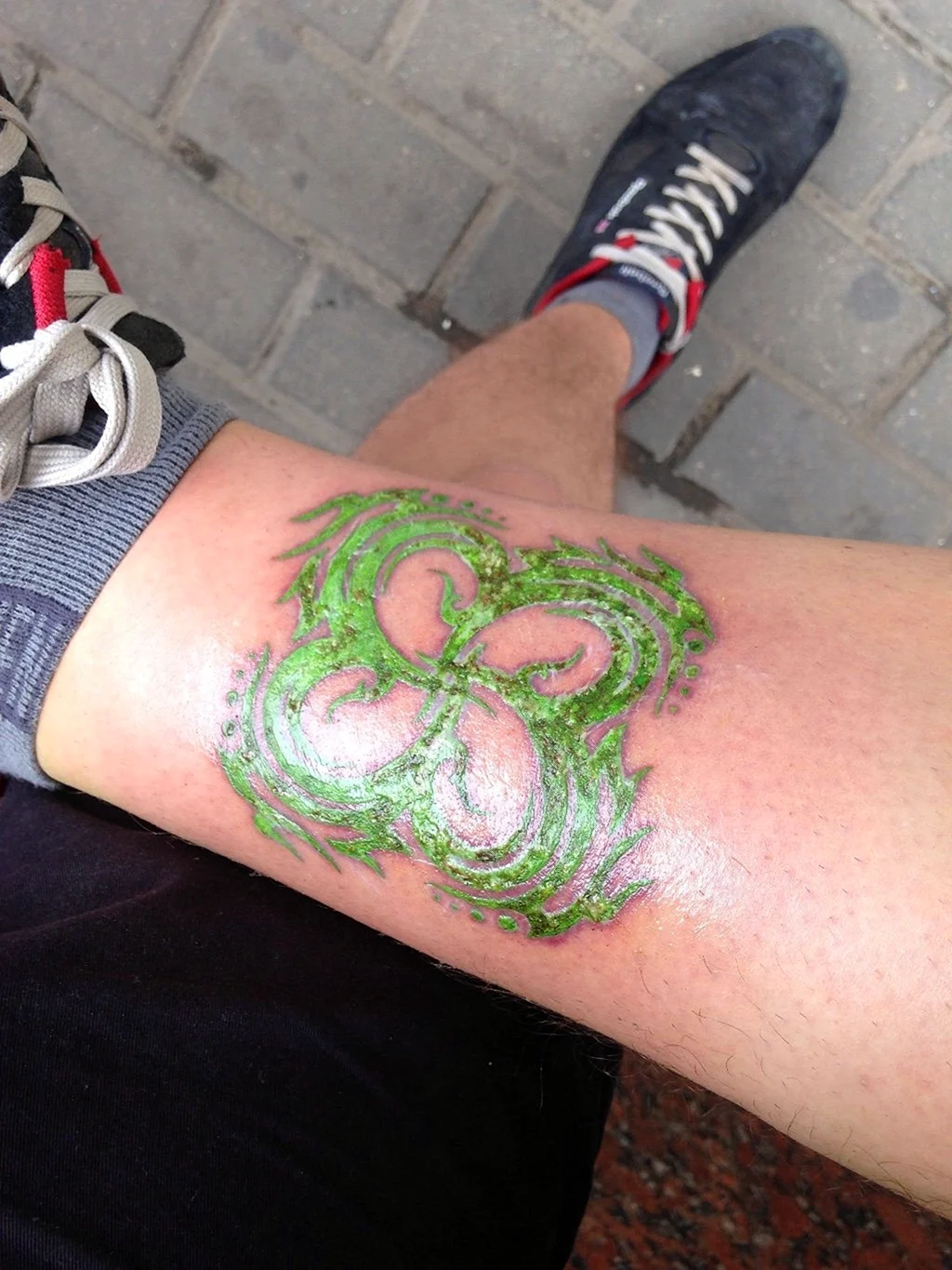 Воспаление Татуировки