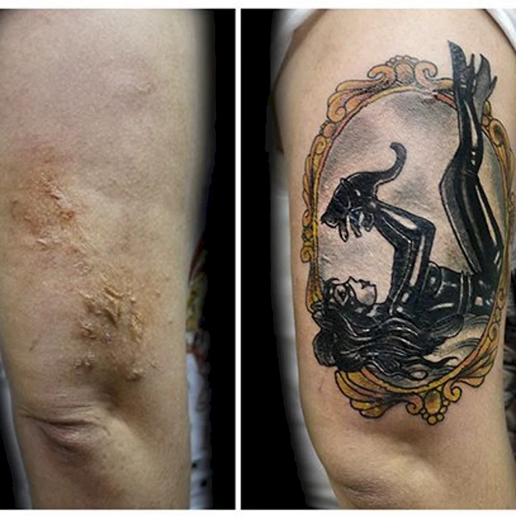 Татуировка вместо шрама