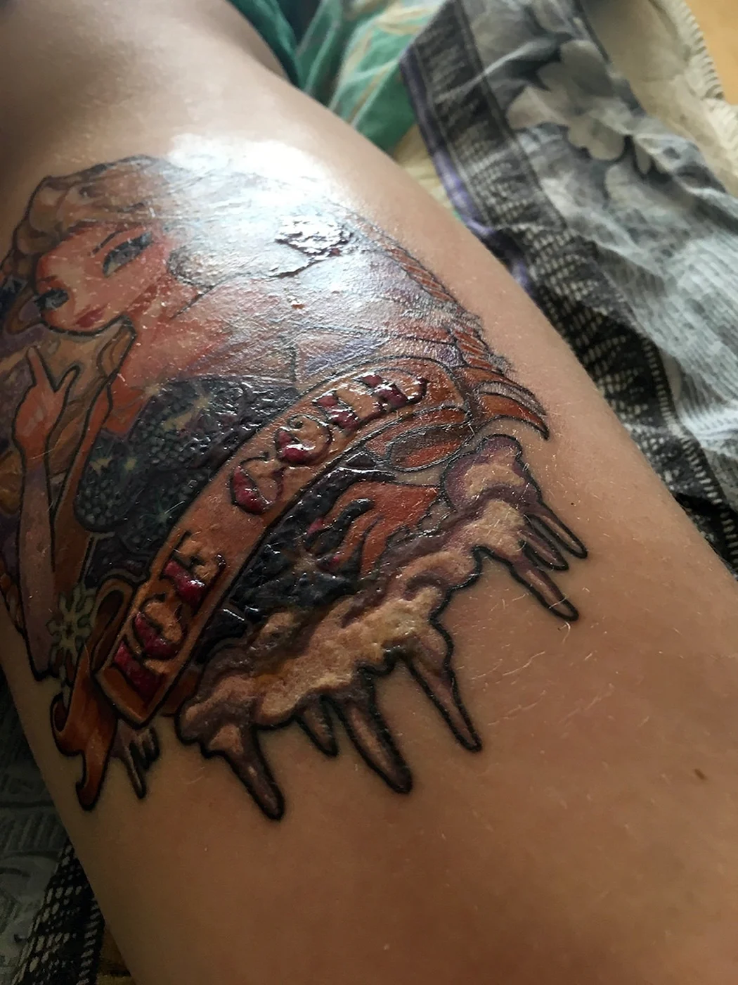 Незажившая Татуировка