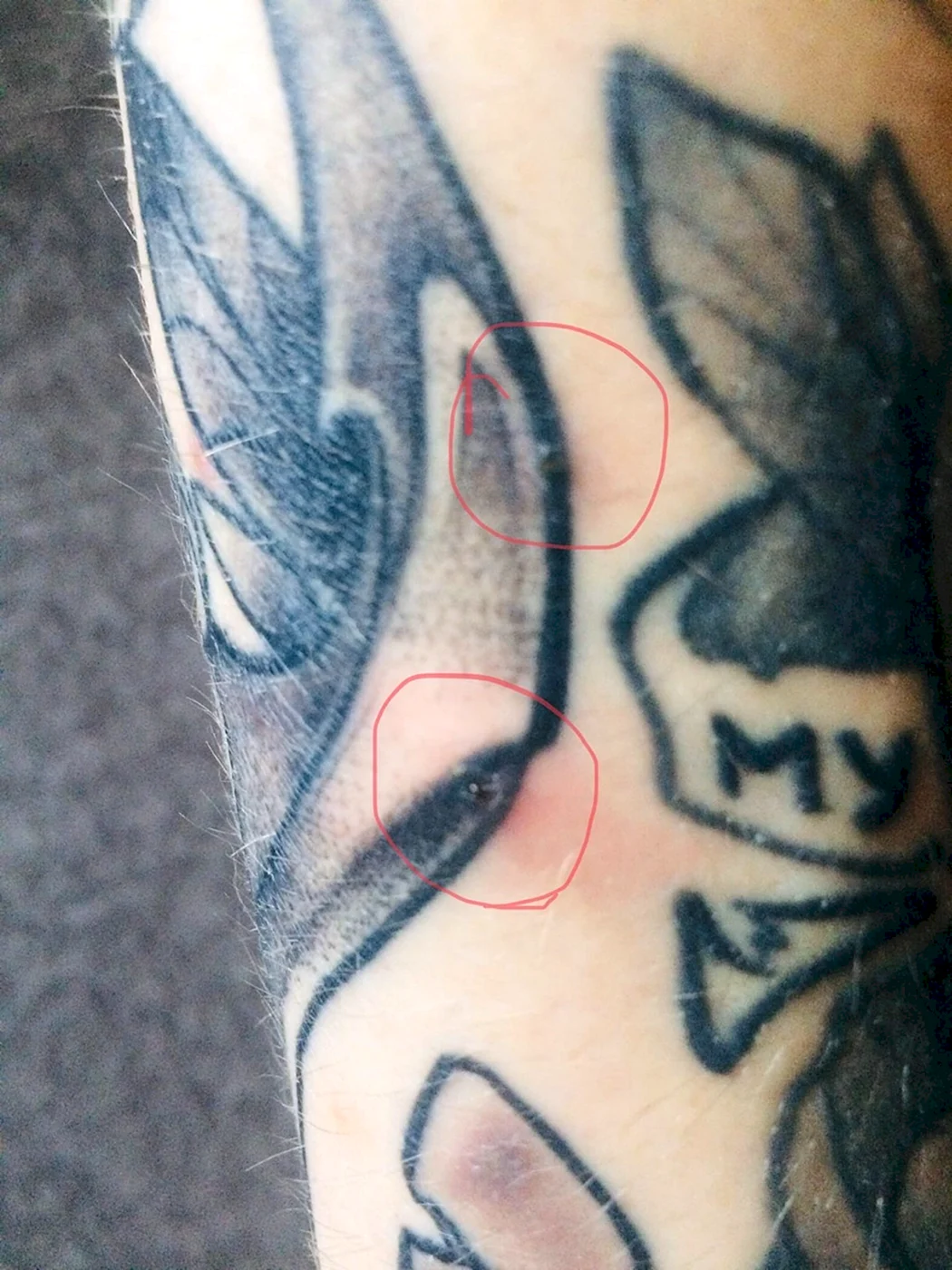 Маленькие прыщики на татуировке