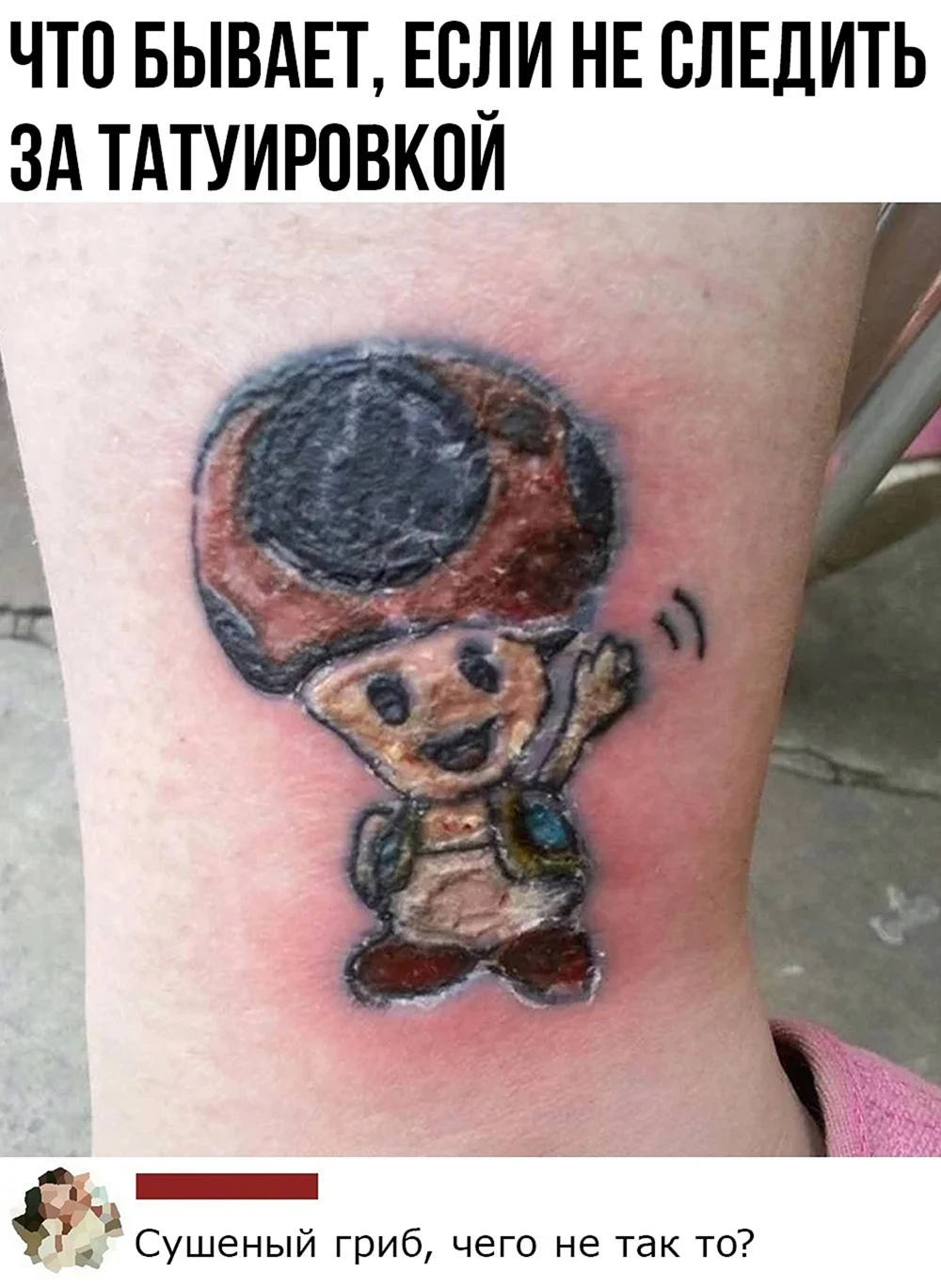 Последствия неудачных тату