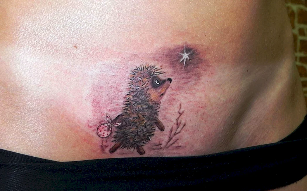 Воспалилась Татуировка