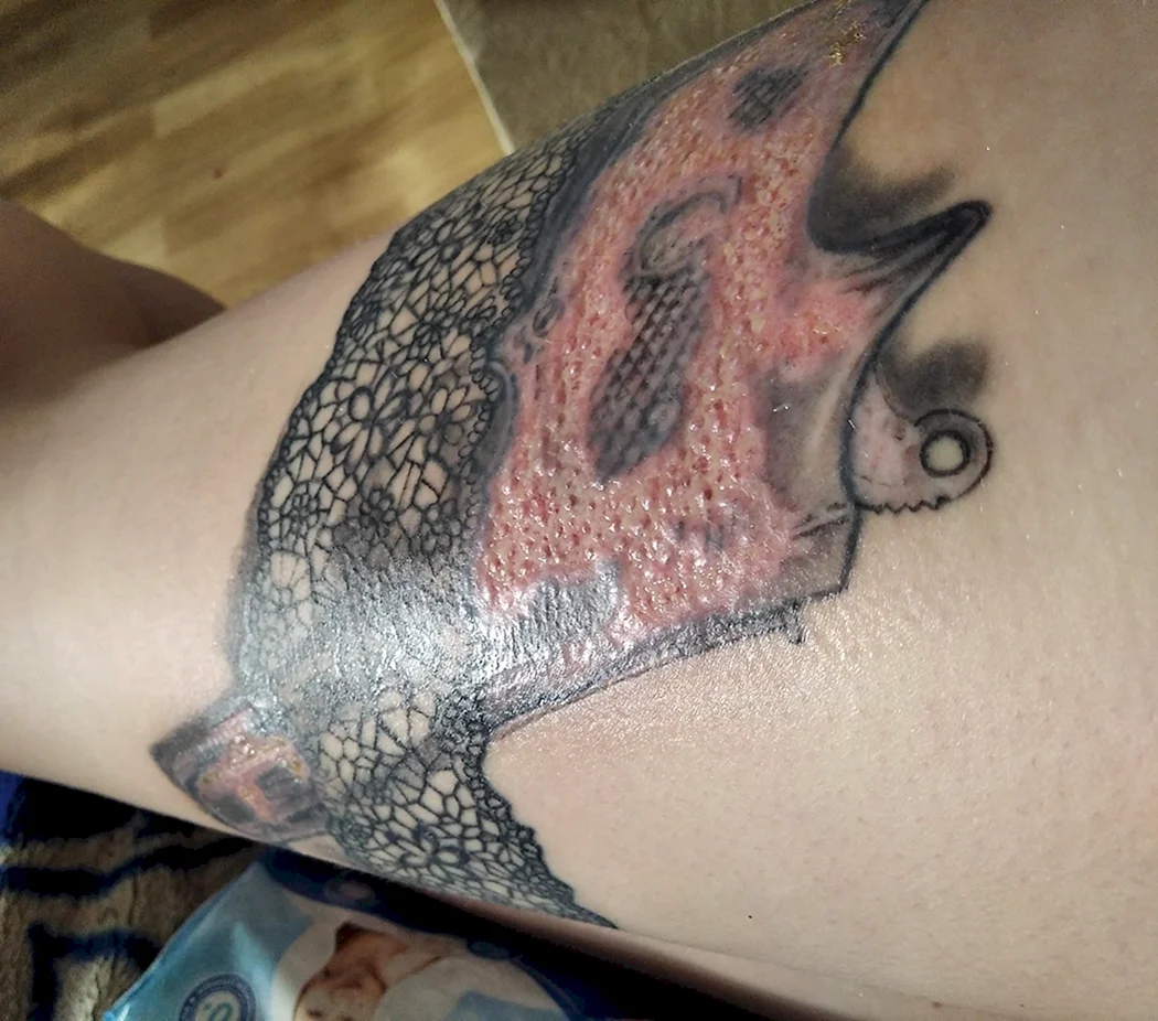 Незажившая Татуировка