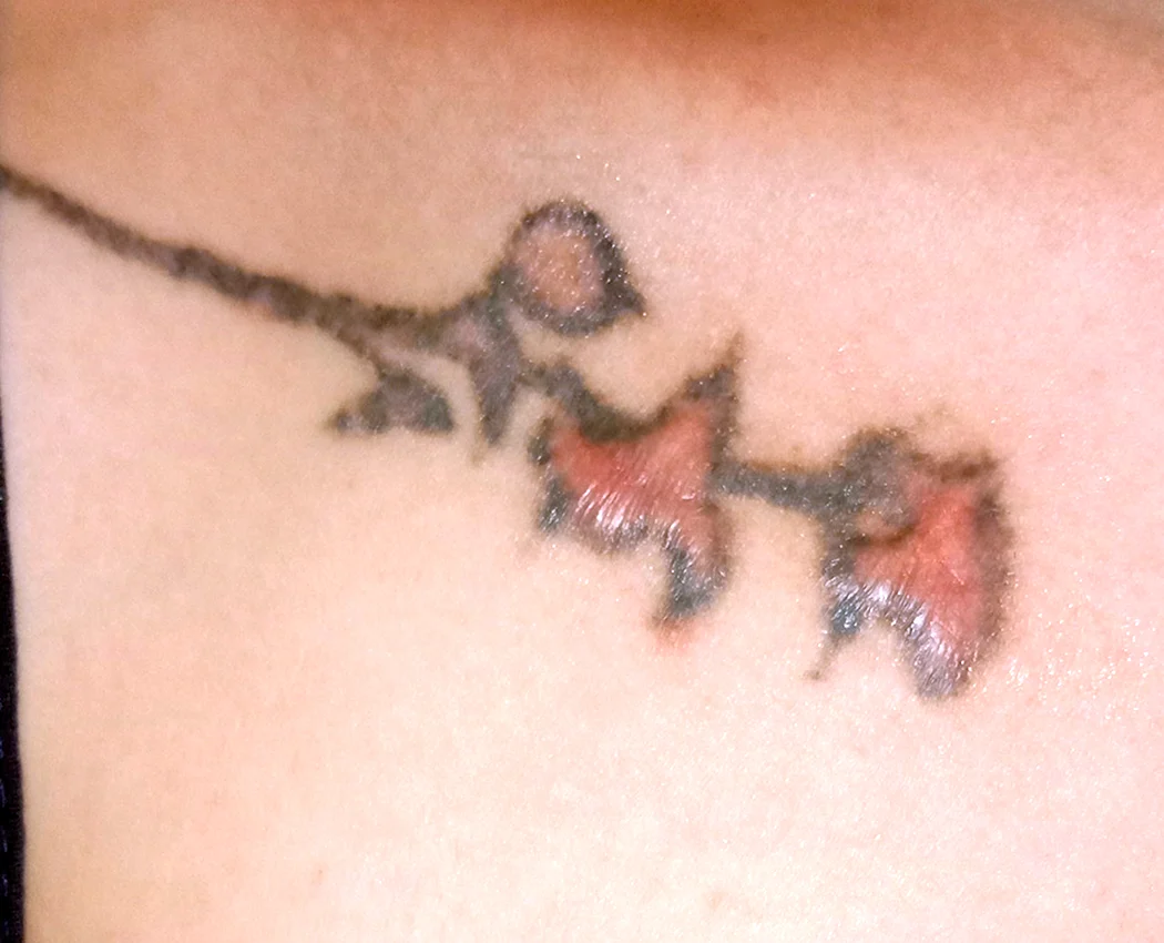 Небольшое воспаление у тату