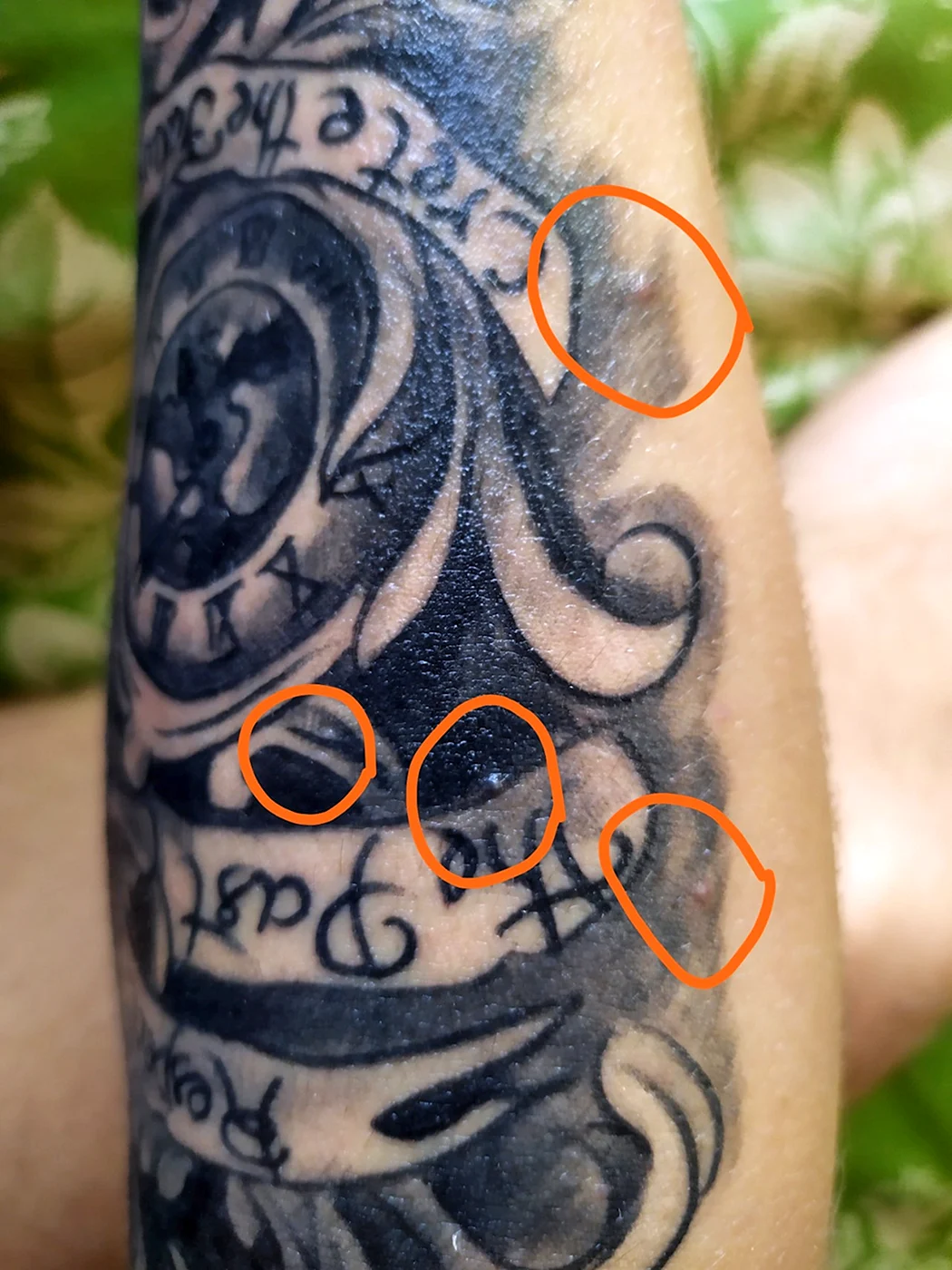 Маленькие пупырышки на татуировке