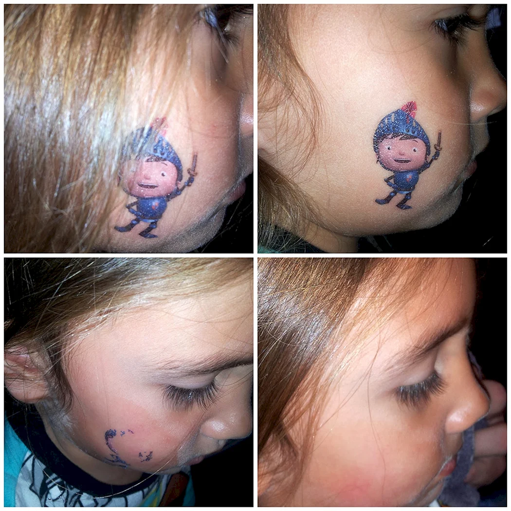 Татуировка на родимом пятне