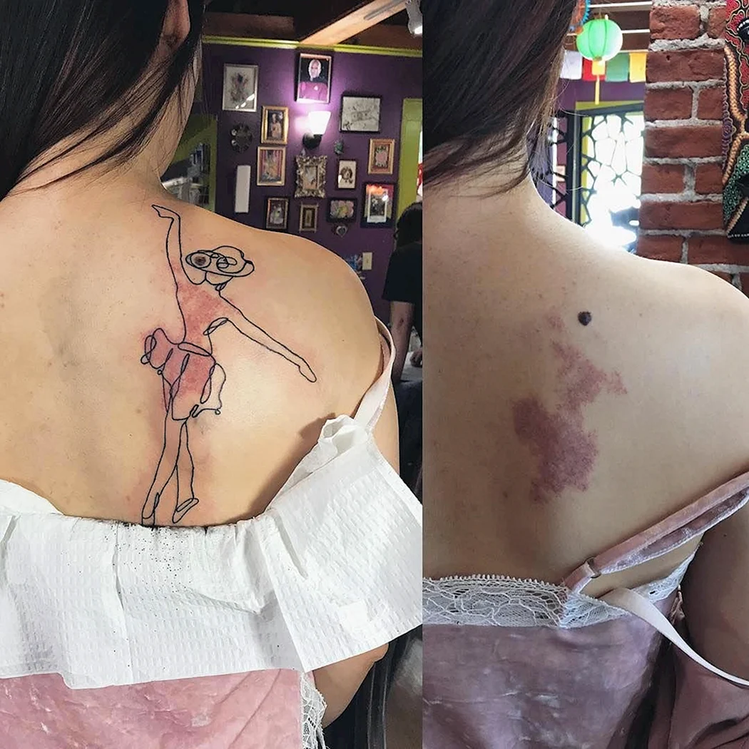 Последствия татуировок