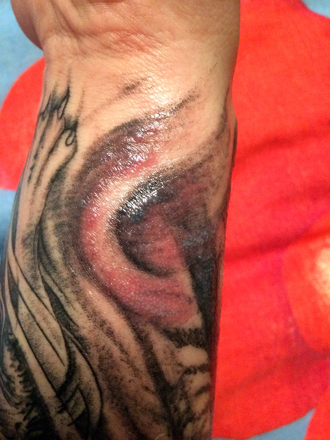 Незажившая Татуировка