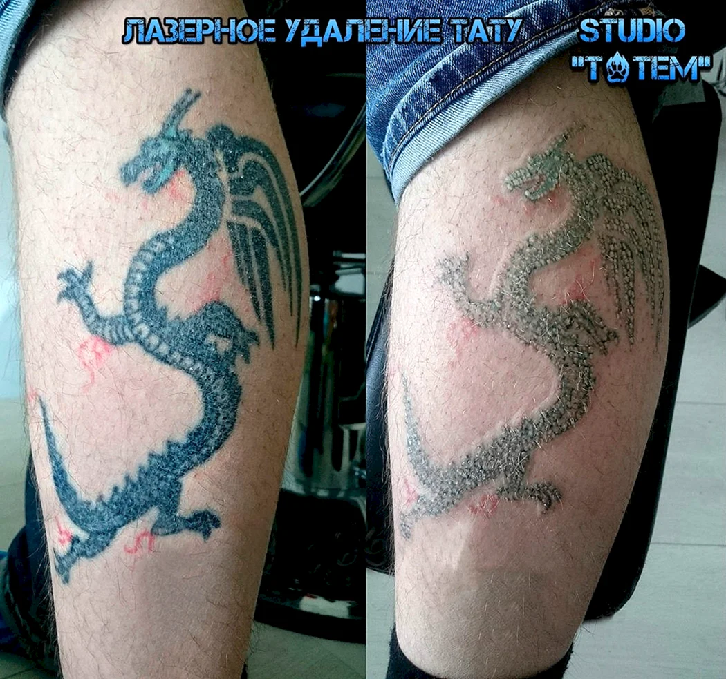 Татуировка до и после заживления