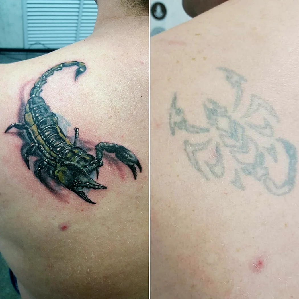 Черная тату после заживления