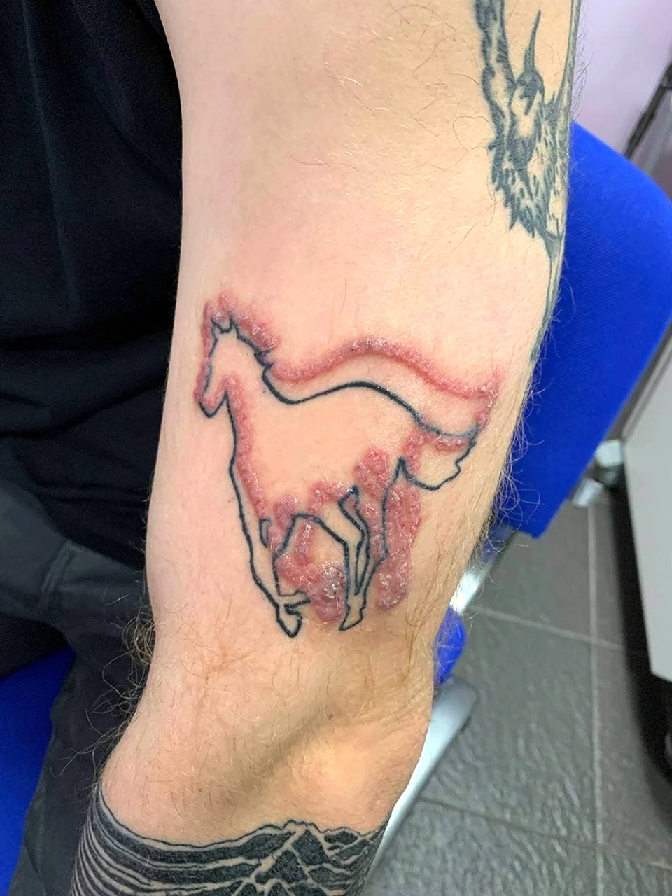 Анестезия для тату