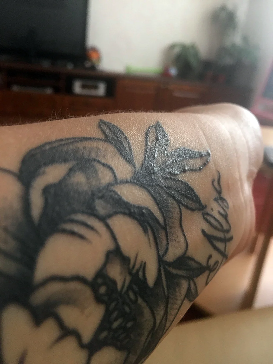 Маленькие прыщики на тату