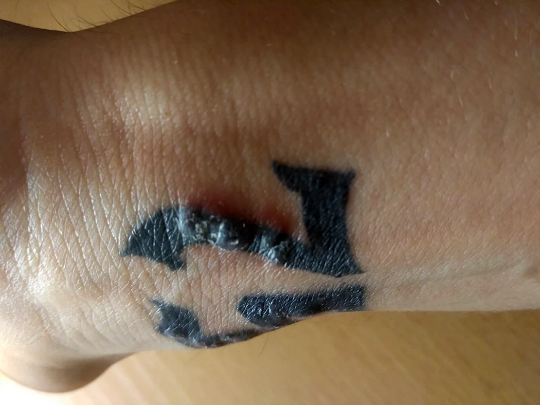 Незажившая Татуировка