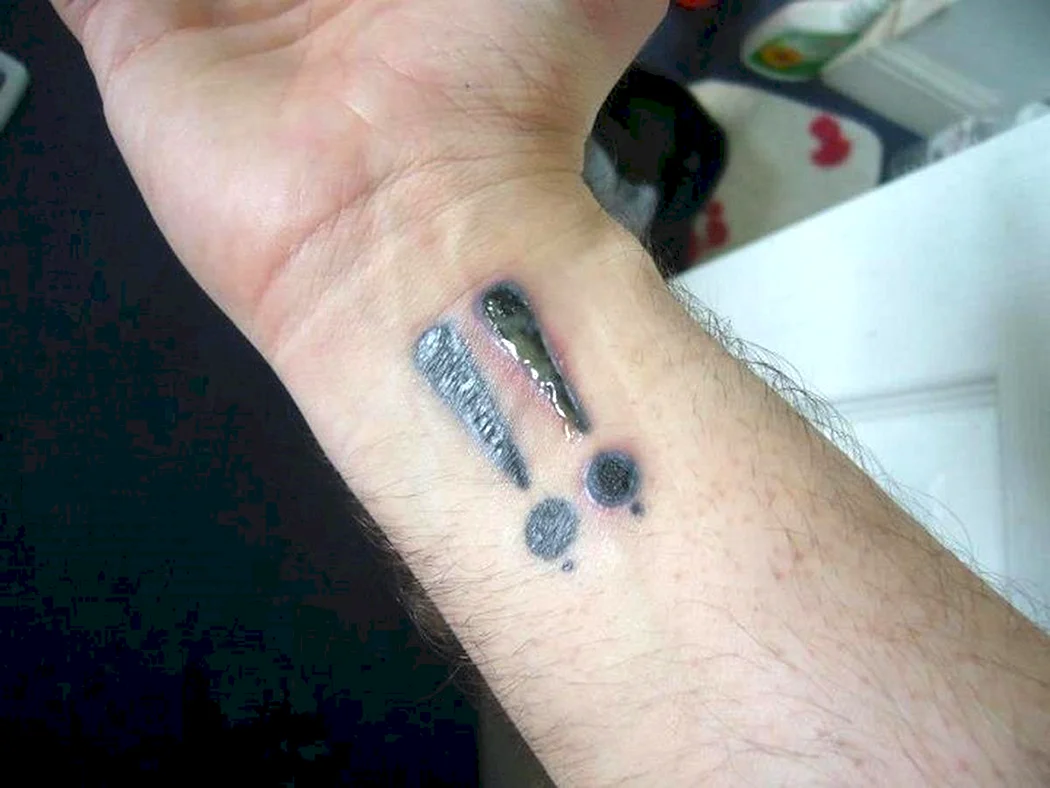 Попадание инфекции в тату
