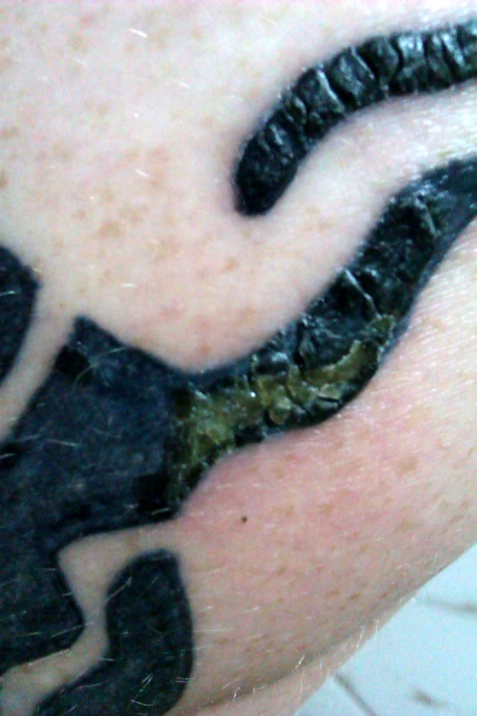 Корочка после Татуировки