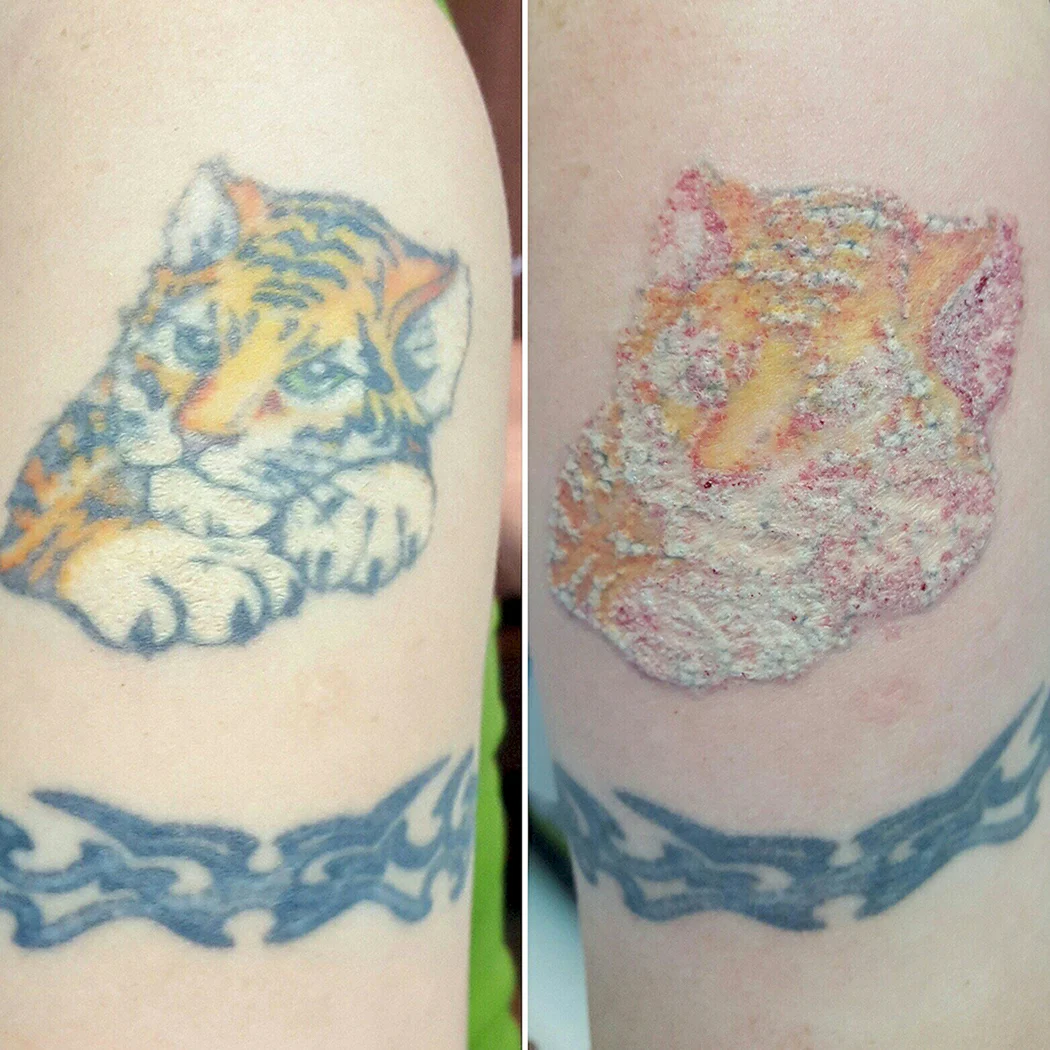 Свести цветную татуировку