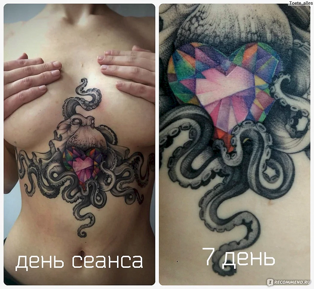 Незажившая Татуировка