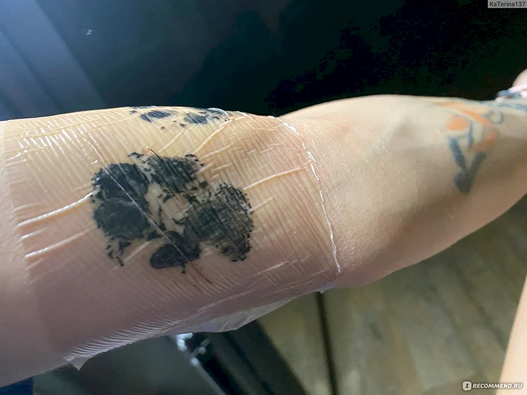 Ранозаживляющие пленки