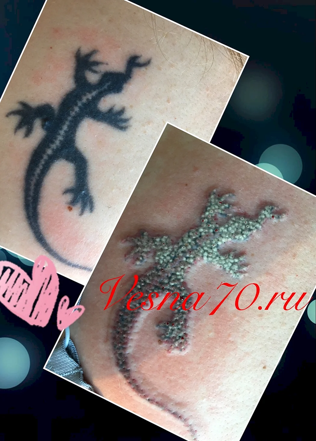 Заживление Татуировки по дням