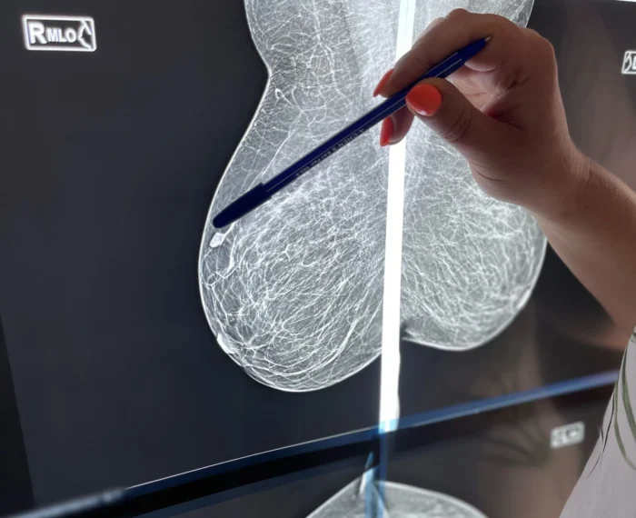 УЗД під час вагітності та лактації